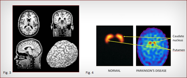 diagnosi